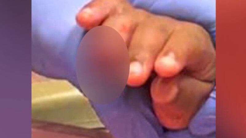 Guardería de Farmville responde después de que un niño de 2 años perdiera parte de su dedo en...