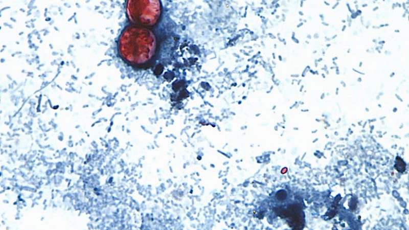 ARCHIVO – En esta imagen sin fecha, tomada mediante un microscopio y proporcionada por los...